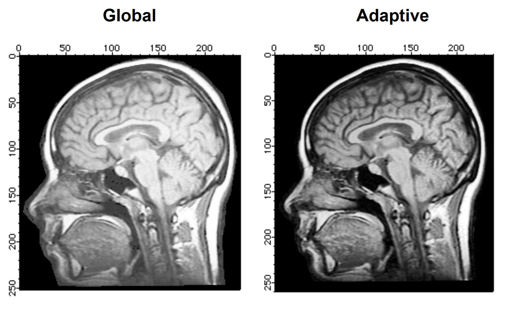 Image Processing | Igor Pro