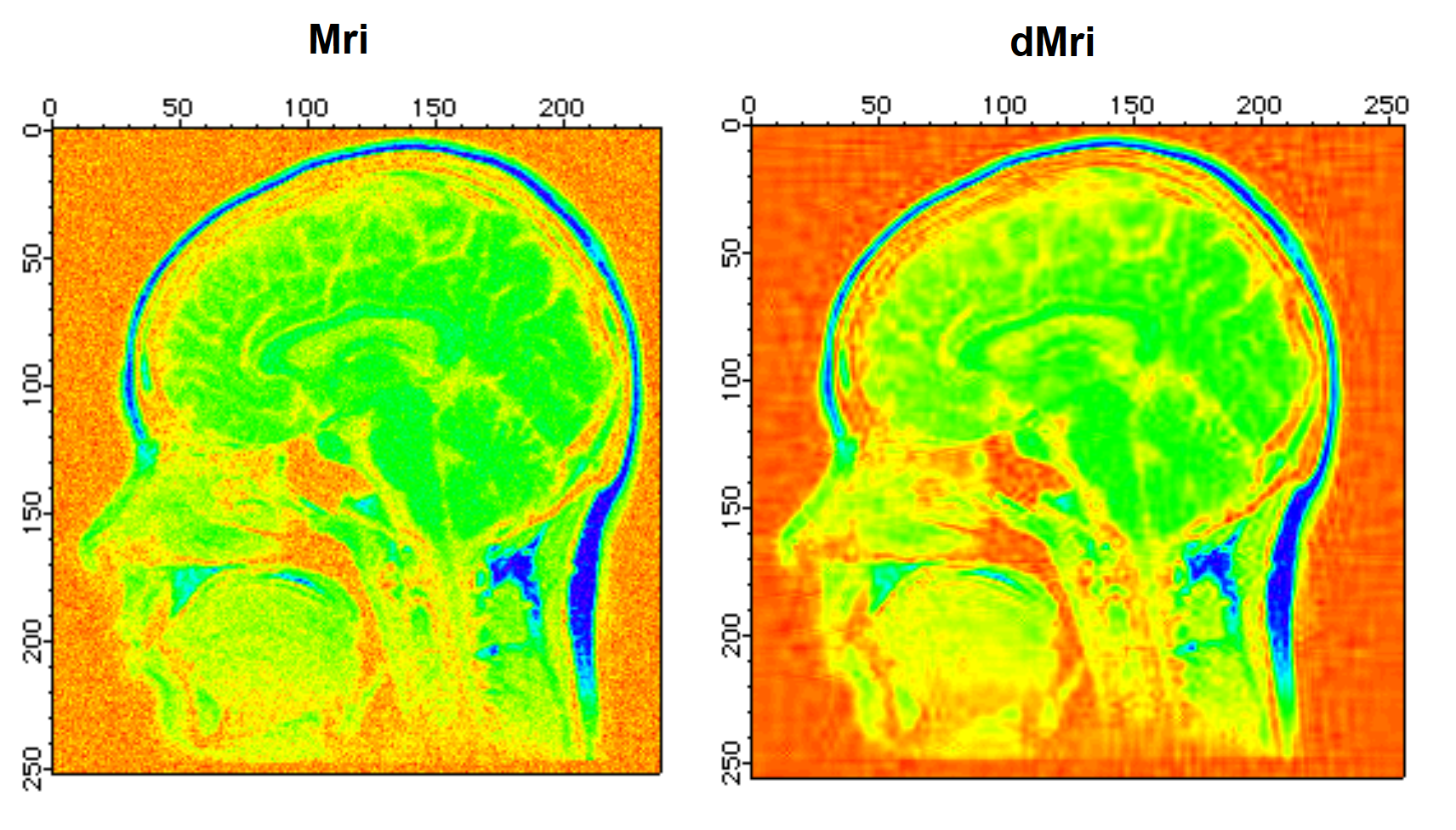 Image Processing | Igor Pro